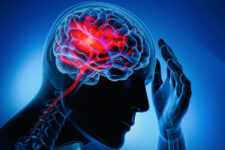 Reduzca los riesgos de un accidente cerebrovascular