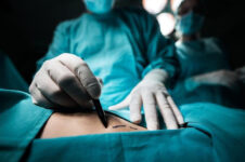 Turismo médico en alerta por muertes en cirugías estéticas