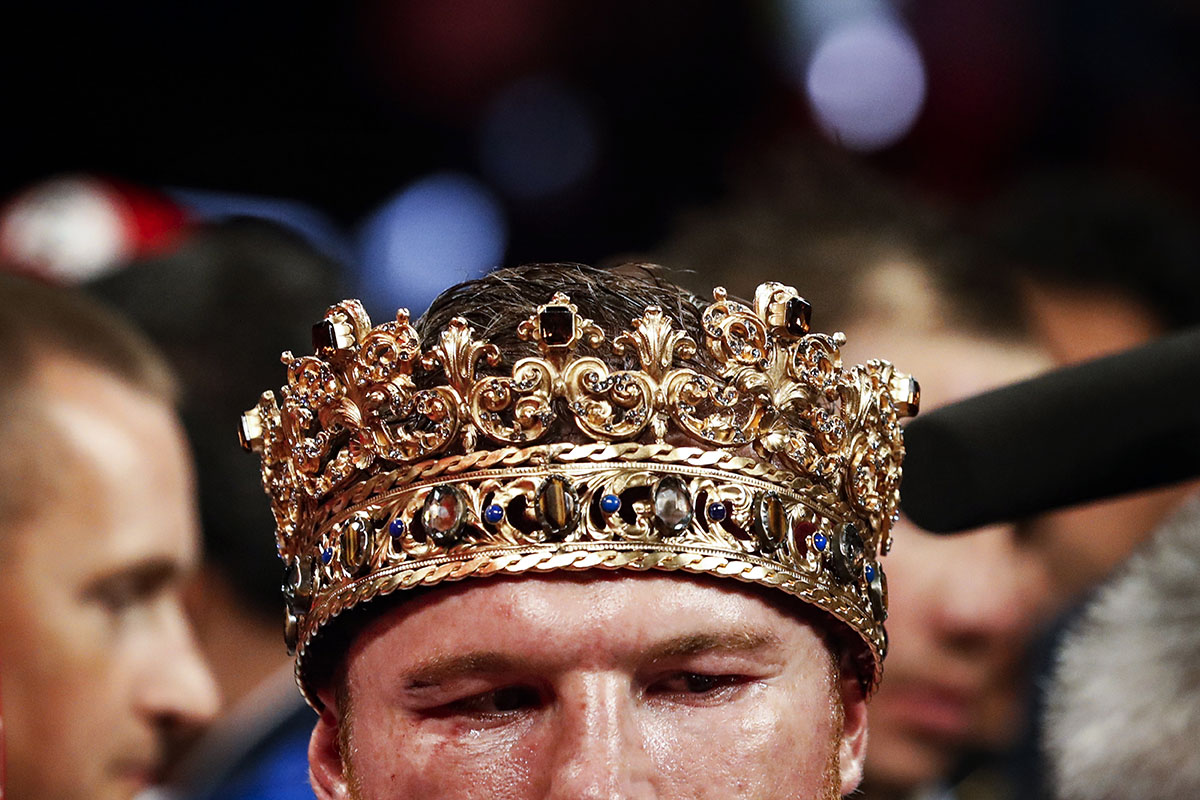 Canelo necesitará cirugía en una mano