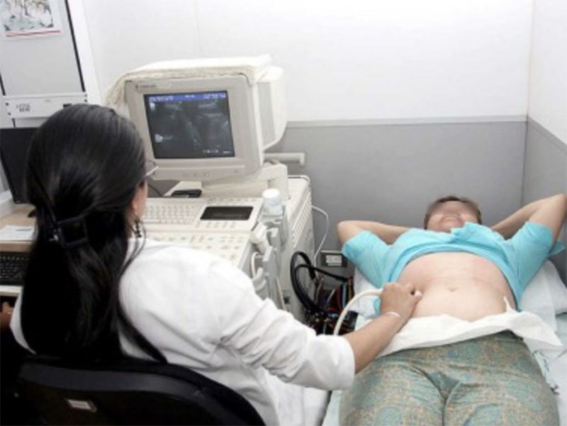 Cáncer de ovario