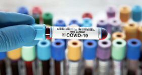 Dangerous and infectious variant of COVID spreads Se propaga peligrosa e infecciosa variante del COVID