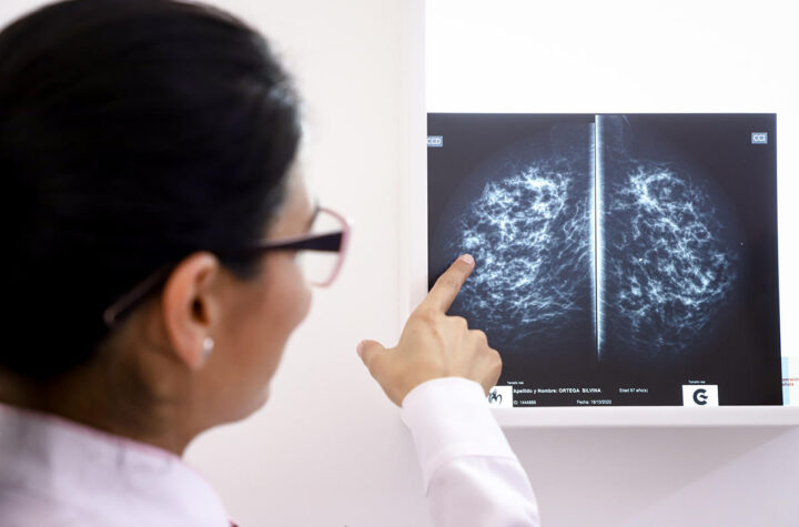 Disminuye mortalidad por cáncer en EE.UU.