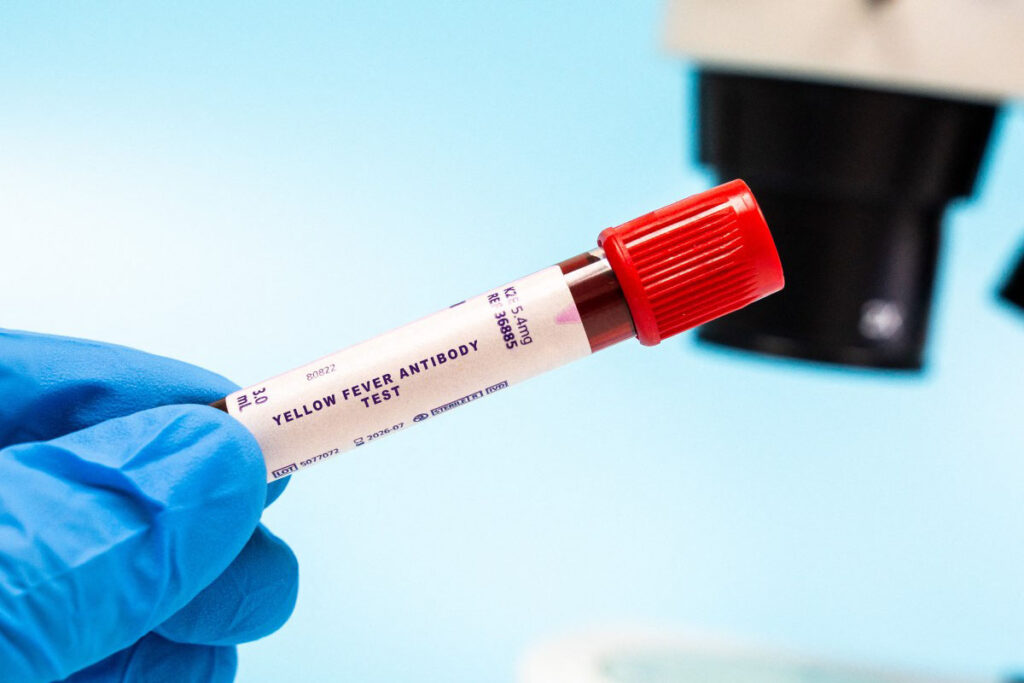 Caso de fiebre amarilla  