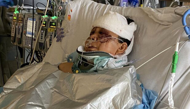 Dueños de pitbulls agresores comparecen en corte el 29 de abril