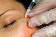 Crece debate ético sobre Botox, Ozempic y cirugías