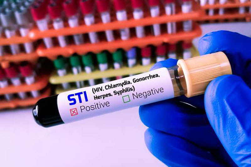 Infórmese sobre las infecciones de transmisión sexual